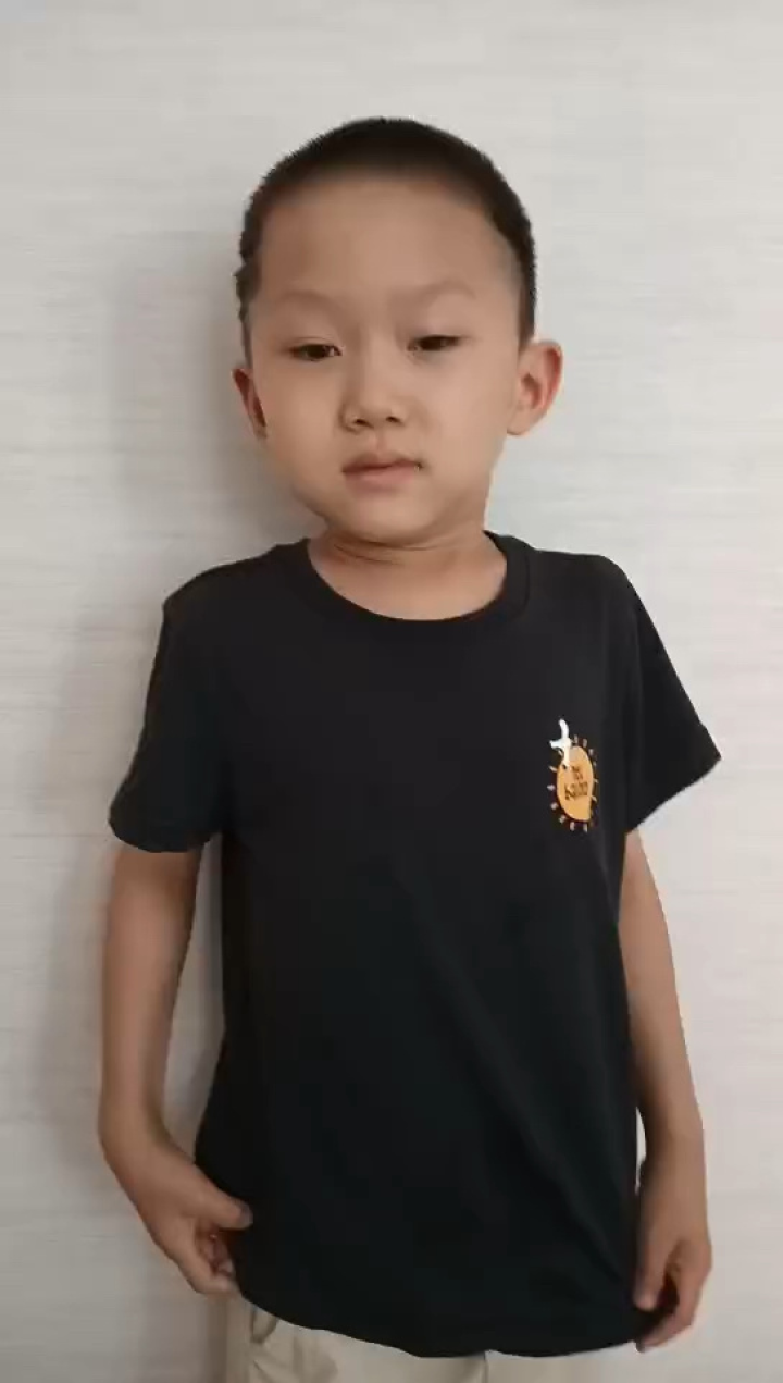 十个月宝宝头被电脑主机磕破了